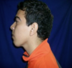 PERF IZQ